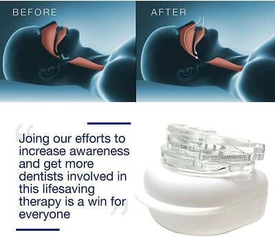 Anti-Snoring Mouthpiece Snore Stopper