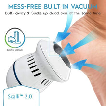 Load image into Gallery viewer, Callus Remover for Dead Skin Feet
