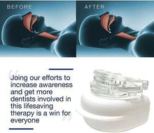 Load image into Gallery viewer, Anti-Snoring Mouthpiece Snore Stopper
